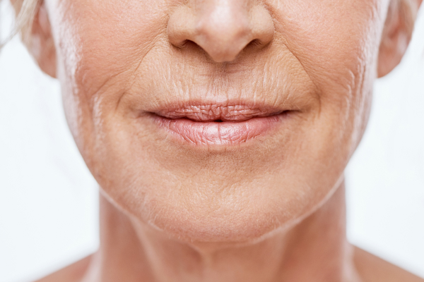 Como prevenir o envelhecimento da pele?