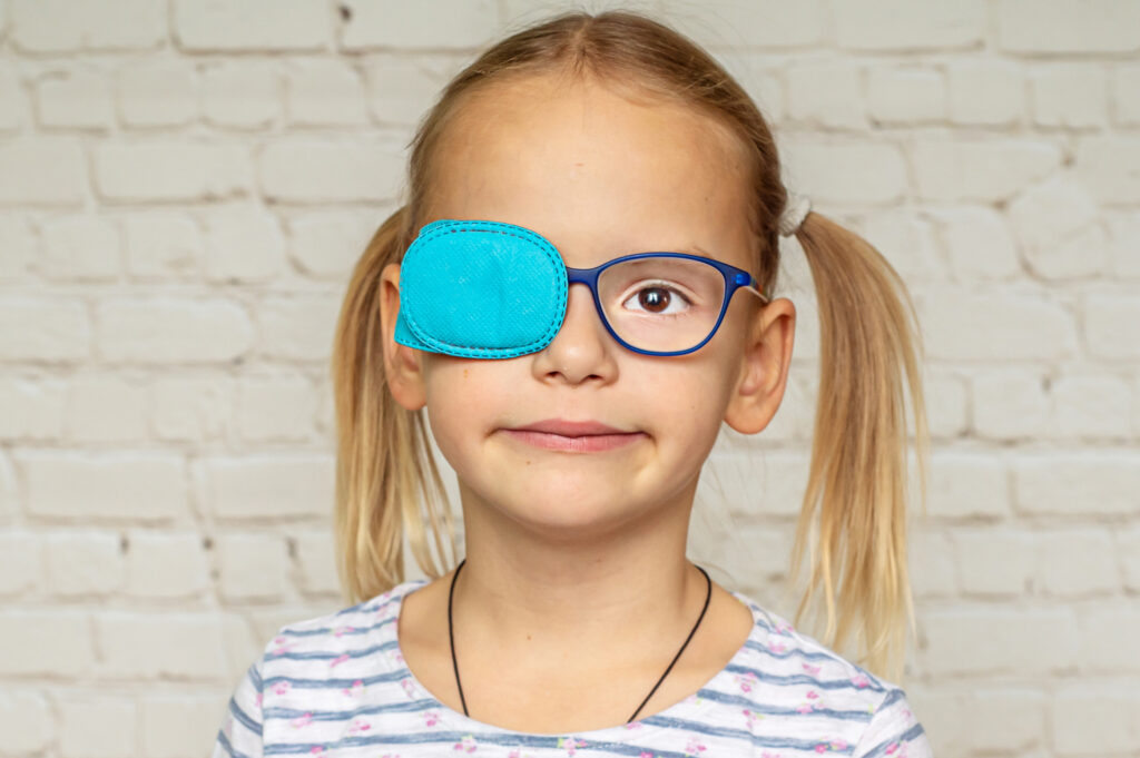 menina com óculos e com um olho tapado - ambliopia