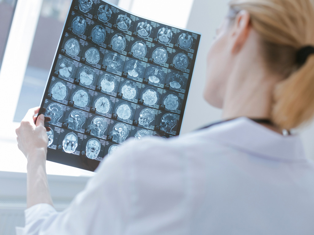 Neurologia